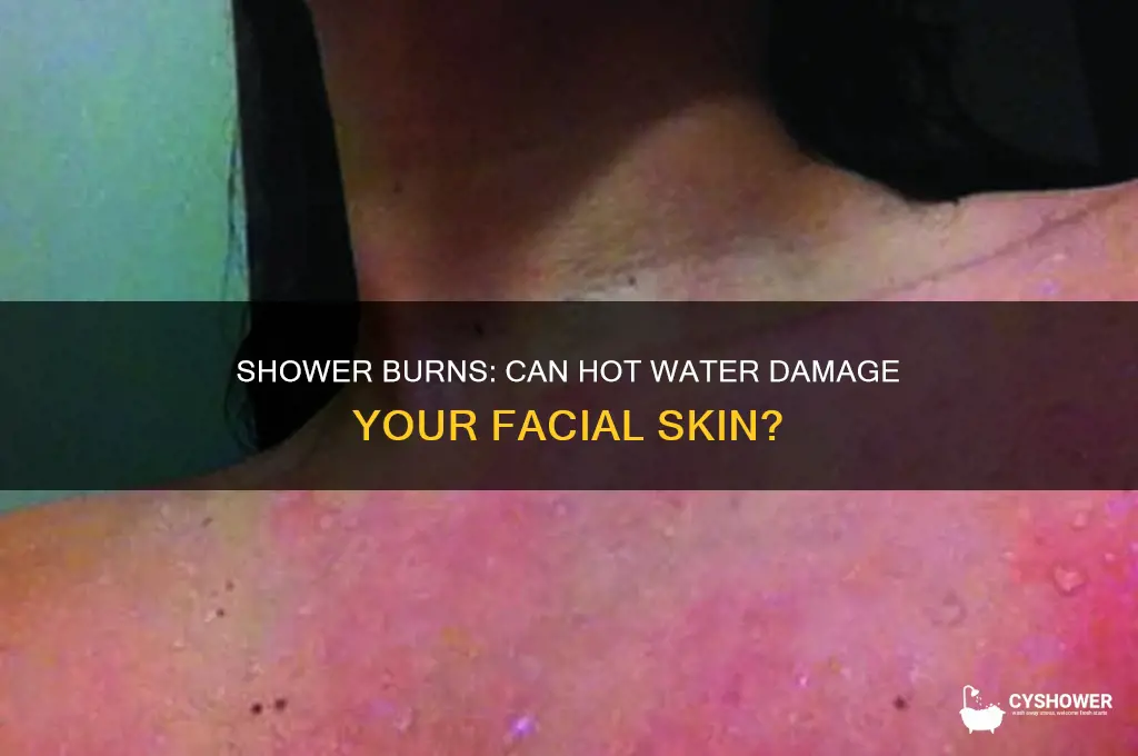 can you burn your face in the shower