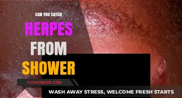 Can You Catch Herpes from a Shower? Debunking the Myth