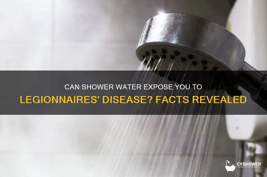 can you catch legionnaires disease from a shower