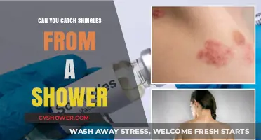 Can Shingles Spread in Showers? Debunking Myths and Facts
