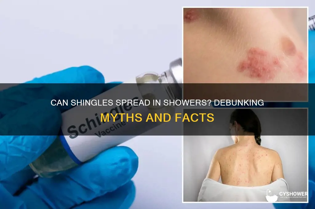 can you catch shingles from a shower