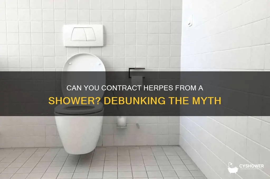can you contract herpes from a shower