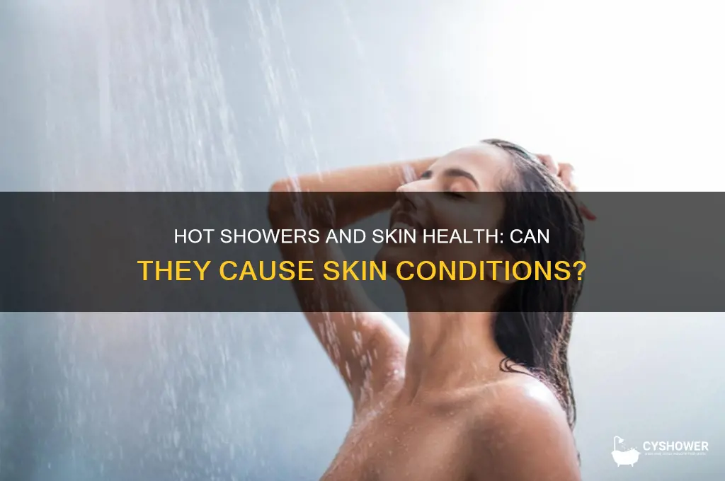 can you get a skin condigion from hot shower
