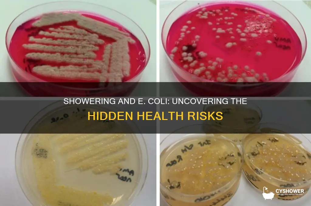 can you get e coli from taking a shower