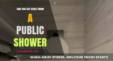 Public Showers and E. Coli: Uncovering the Hidden Health Risks