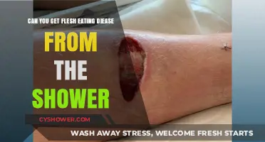 Shower Safety: Can You Contract Flesh-Eating Disease from Your Shower?