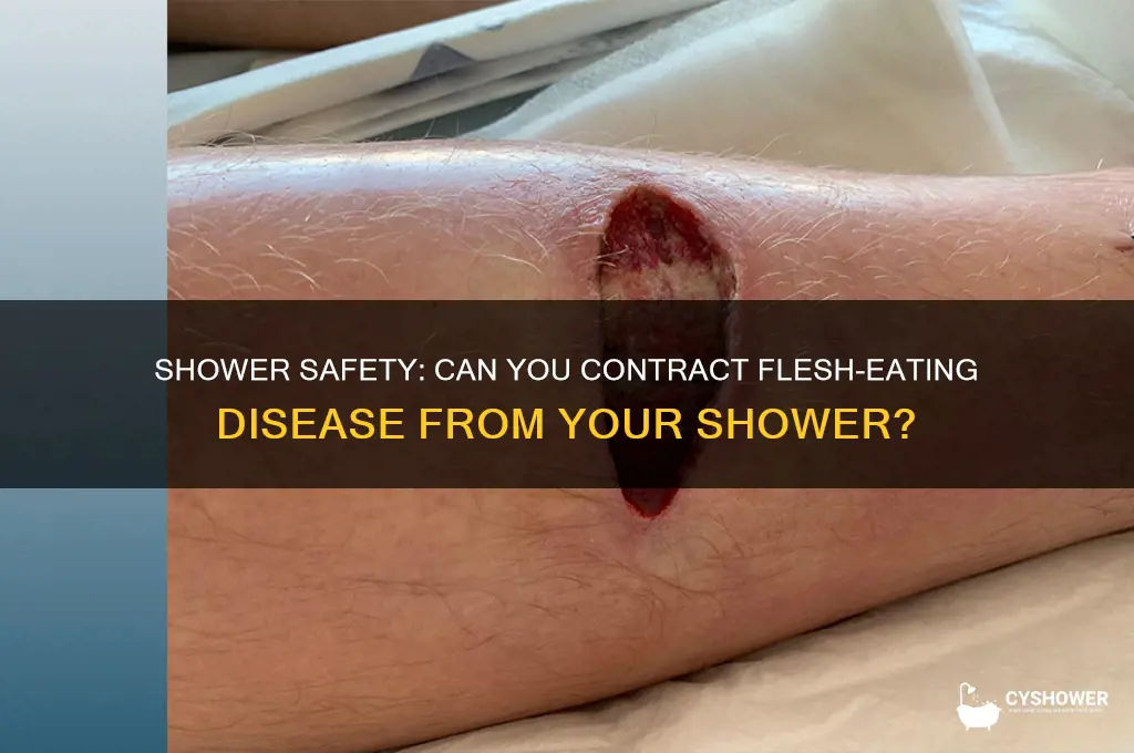 can you get flesh eating diease from the shower