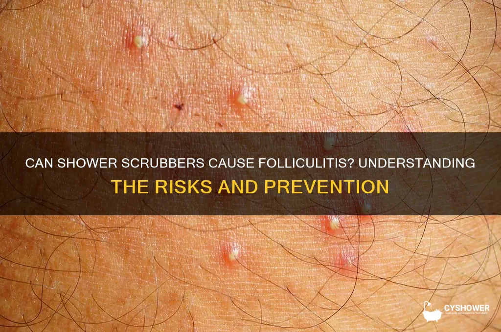 can you get folliculitis from a shower scrubber