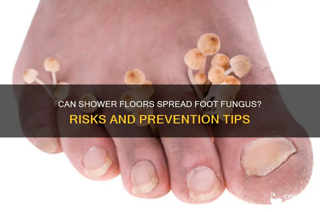 can you get foot fungus from a shower