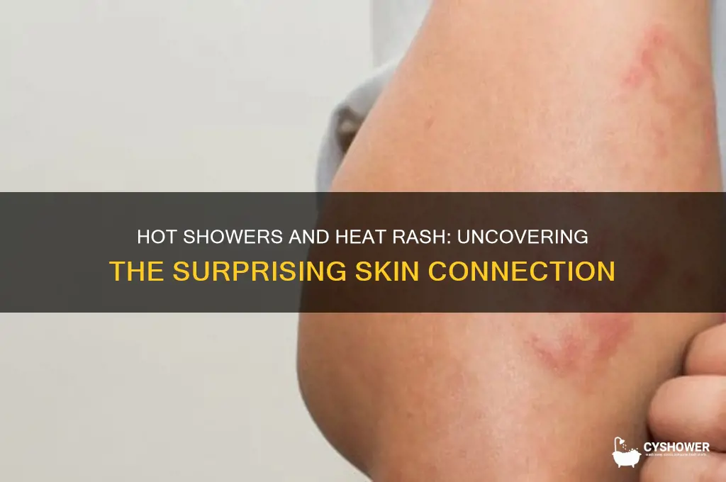 can you get heat rash from a hot shower