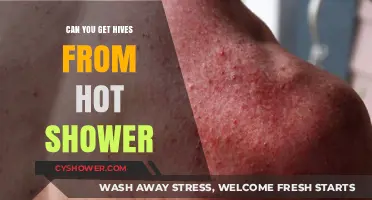 Hot Showers and Hives: Unraveling the Skin Reaction Mystery
