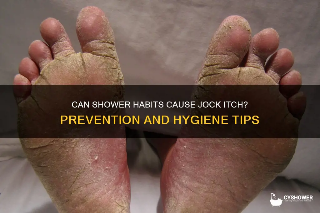 can you get jock itch from the shower