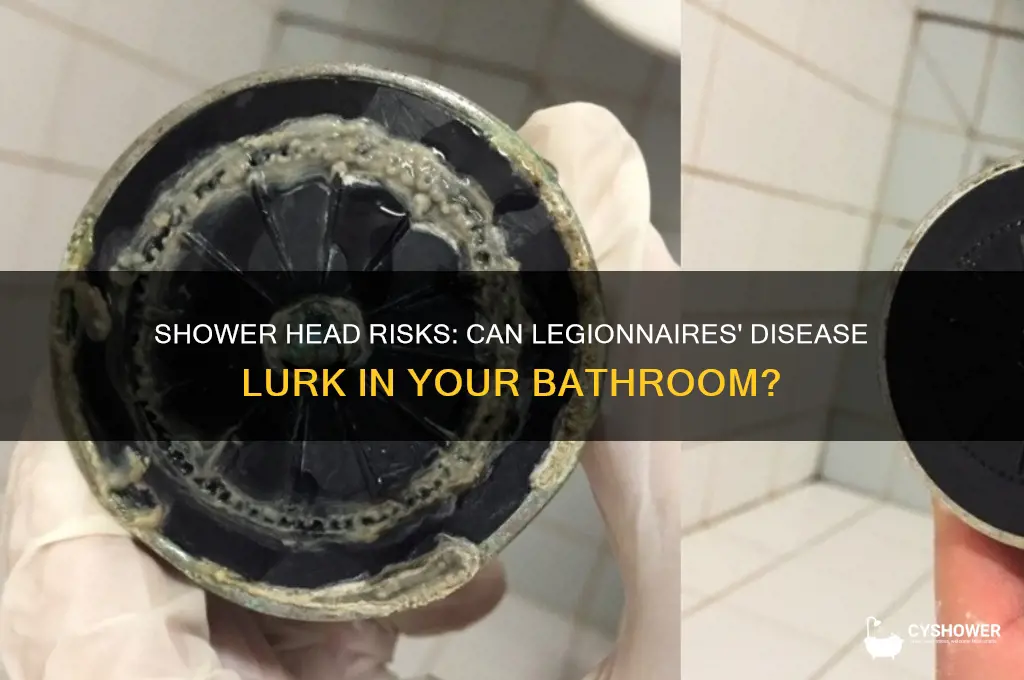 can you get legionnaires disease from a shower head