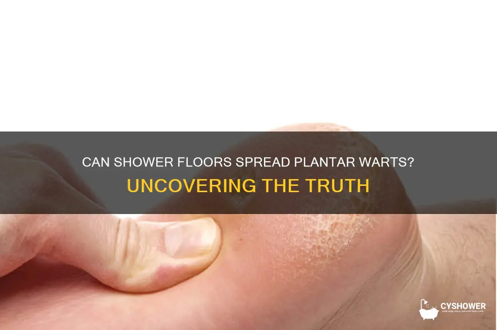 can you get plantar warts from the shower