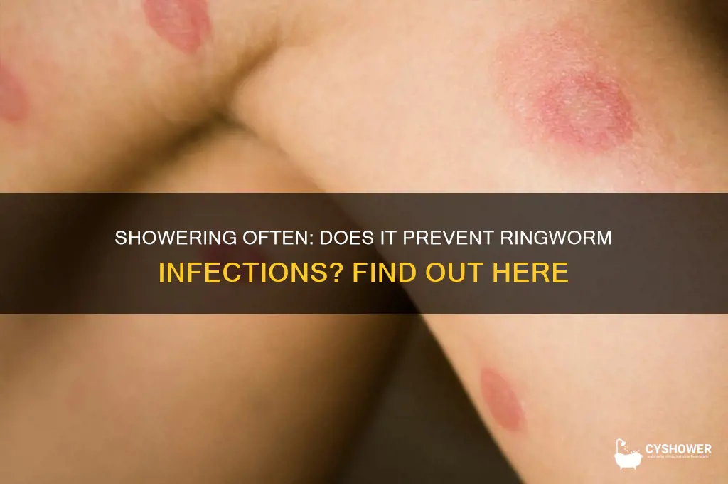can you get ringworms if you shower often