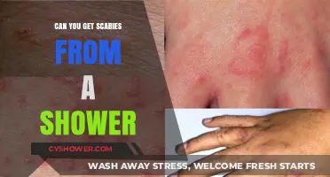 Can Shower Sharing Spread Scabies? Debunking Common Myths and Facts