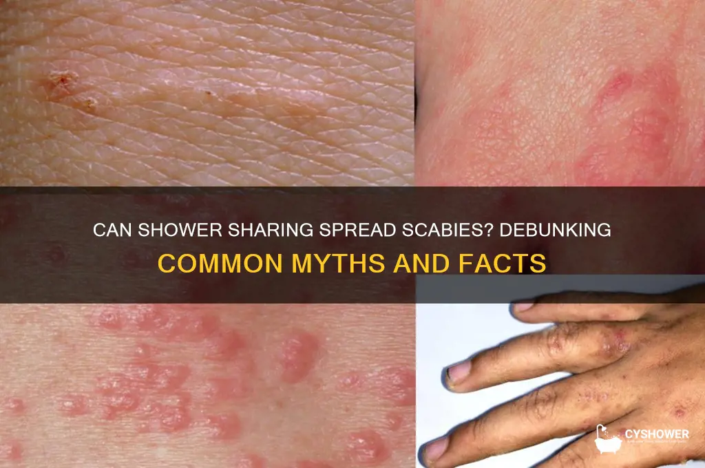 can you get scabies from a shower