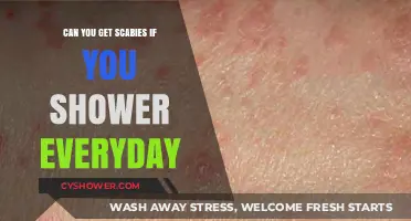 Daily Showers and Scabies: Can Hygiene Prevent Infestation?