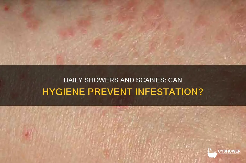can you get scabies if you shower everyday