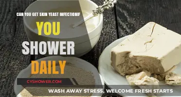 Daily Showers and Skin Yeast Infections: What's the Connection?