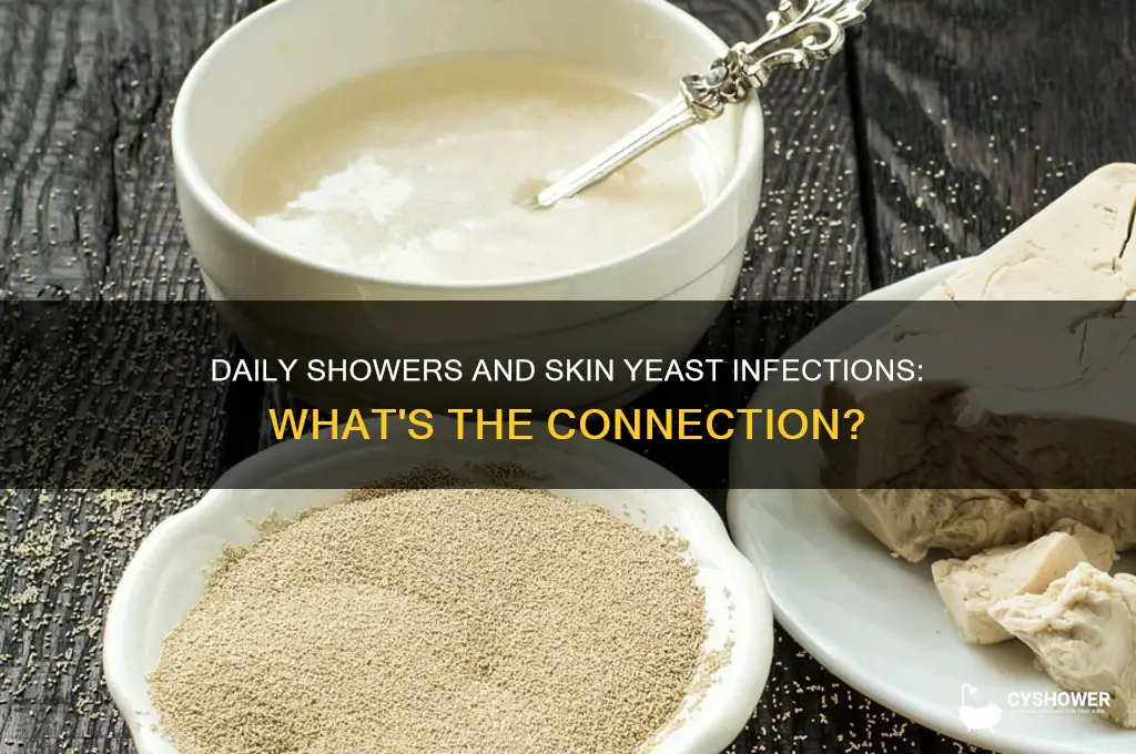 can you get skin yeast infectionif you shower daily
