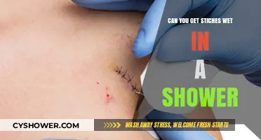 Showering with Stitches: Can You Safely Get Them Wet?