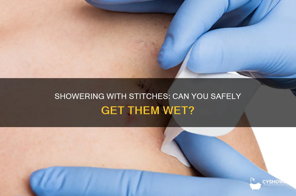 can you get stiches wet in a shower