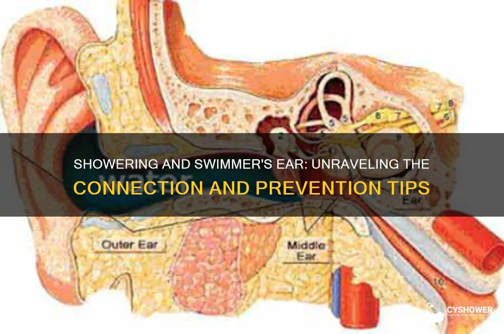 can you get swimmer