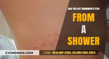 Can Shower Water Cause Swimmer's Itch? Facts and Prevention Tips