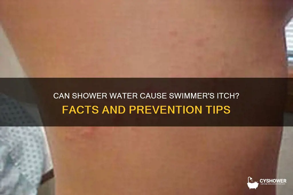 can you get swimmer