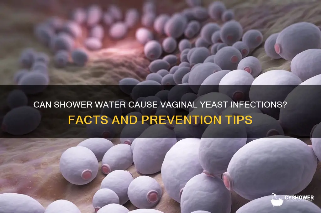 can you get vagina yeast infection from shower water