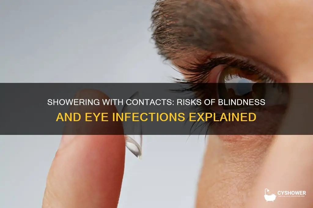 can you go blind from wearing contacts in the shower