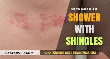 Shingles and Bathing: Safe Practices for Showering or Bathing with Shingles