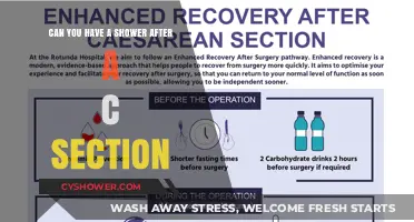 Post-C-Section Shower Guide: When and How to Safely Shower