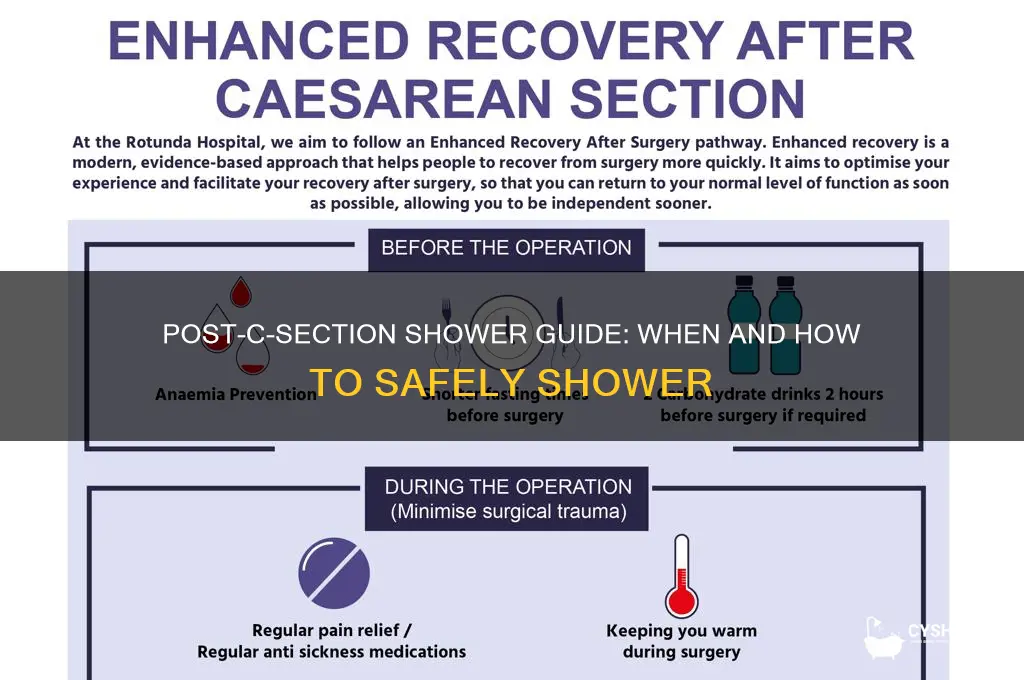 can you have a shower after a c section