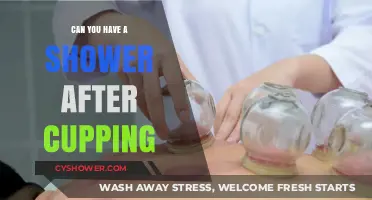 Shower After Cupping: Safe Practice or Risky Move?