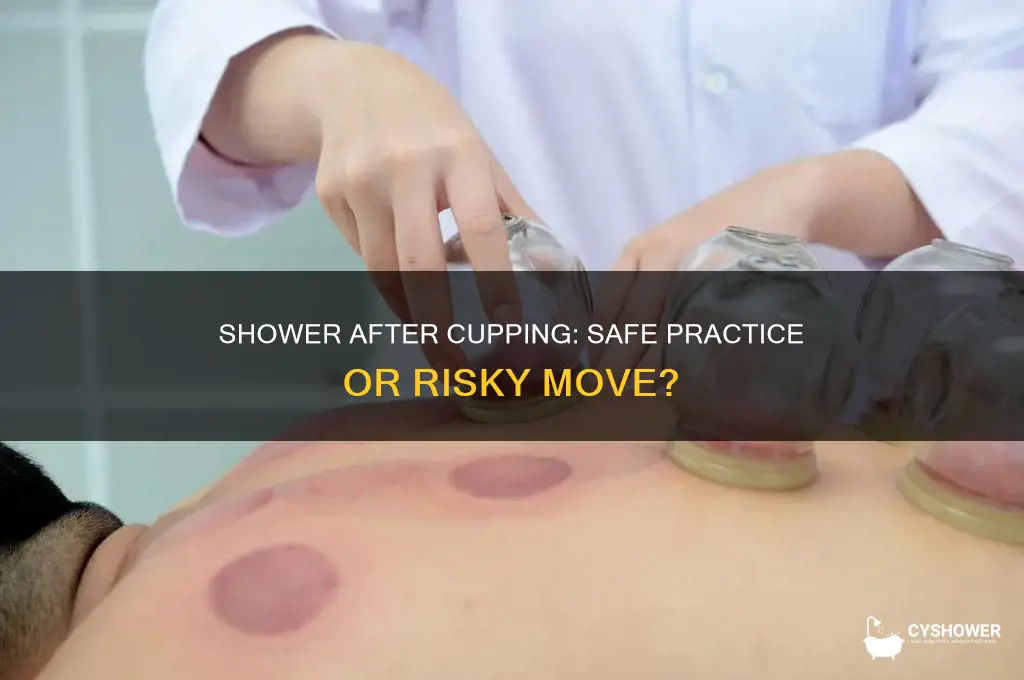 can you have a shower after cupping