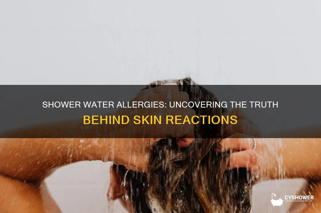 can you have an allergic reaction to shower water