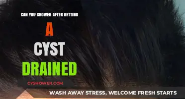 Showering After Cyst Drainage: Safe Practices and Post-Procedure Care Tips