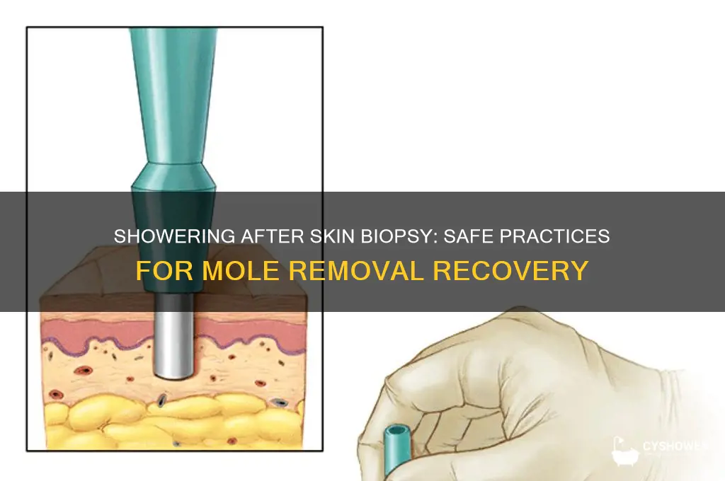 can you shower after getting a skin biopsy mole