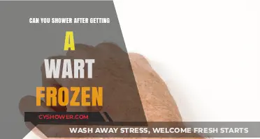 Showering After Wart Freezing: What You Need to Know