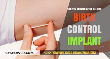 Showering Safely After Birth Control Implant: What You Need to Know