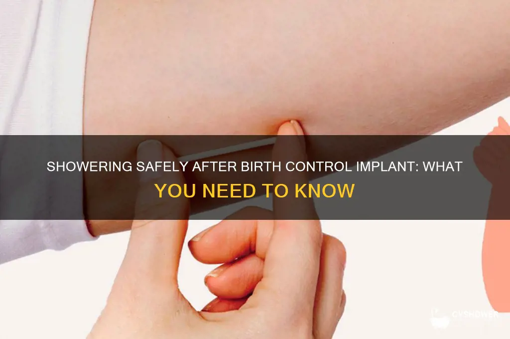 can you shower after getting birth control implant