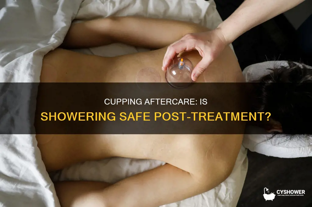can you shower after getting cupping