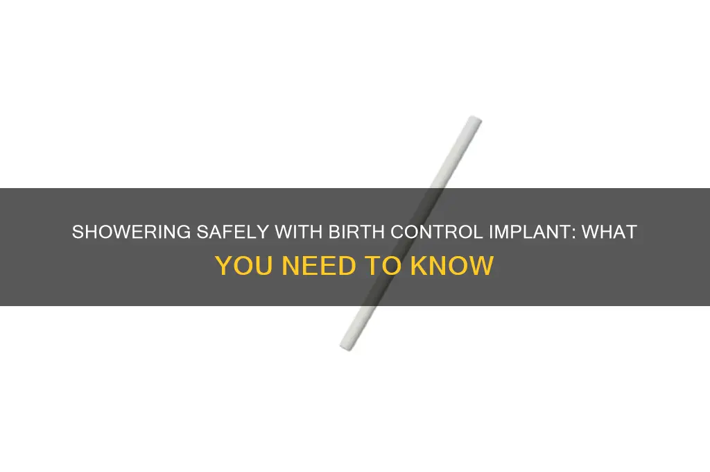can you shower when you get birth control implant