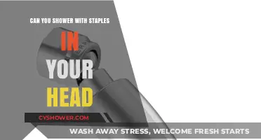 Showering with Staples in Your Head: Safe or Risky?