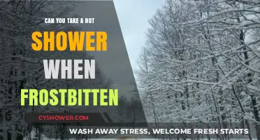 Frostbite and Hot Showers: Safe Practices for Recovery and Relief