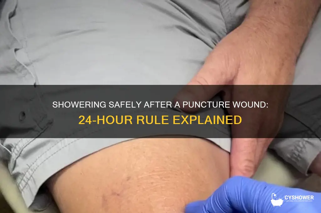 can you take a shower 24 hours after puncture wound