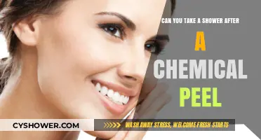 Showering After a Chemical Peel: What You Need to Know
