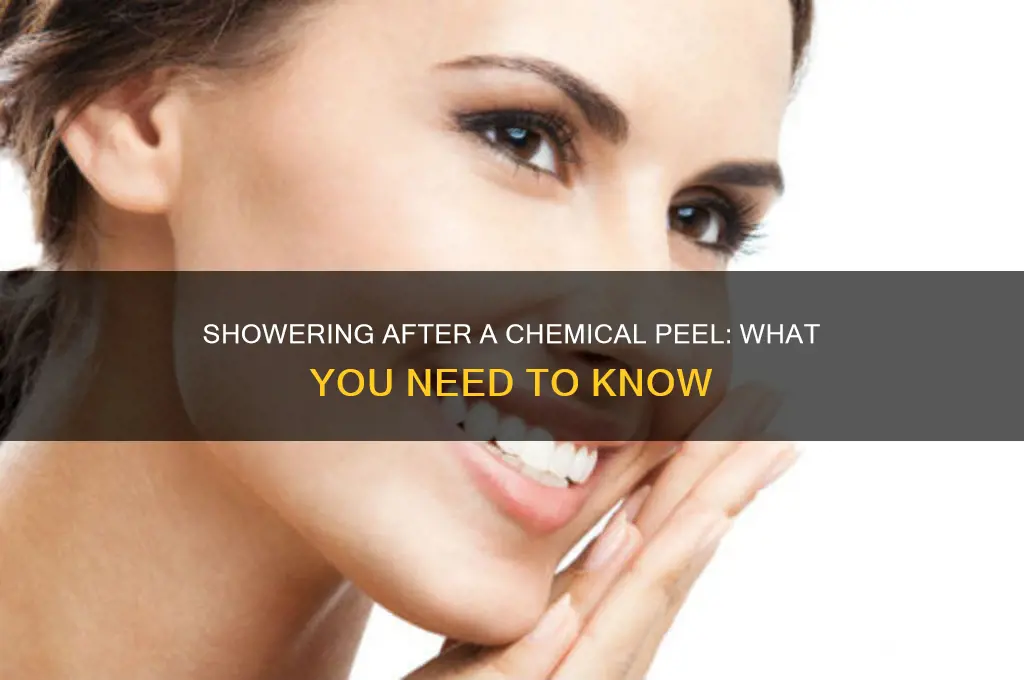 can you take a shower after a chemical peel